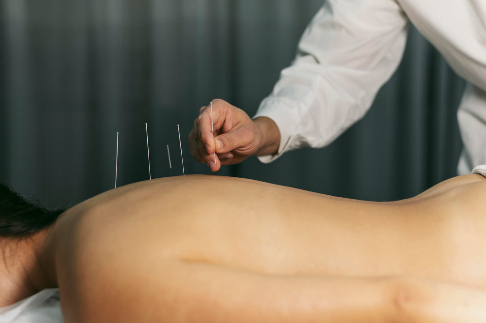 The Validity of Acupuncture in Sports